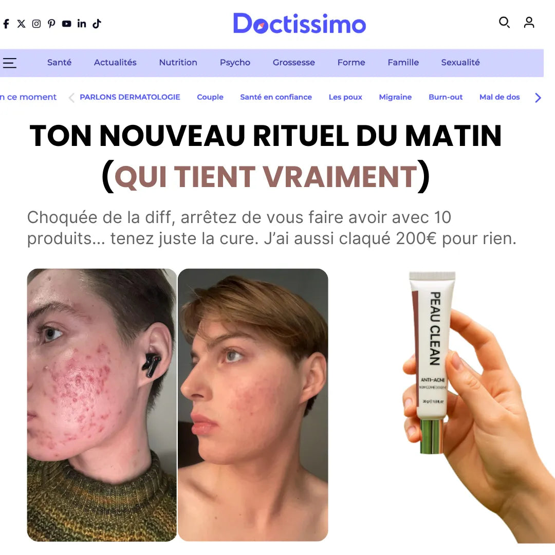 Cure Clean – Des résultats visibles en 7 jours