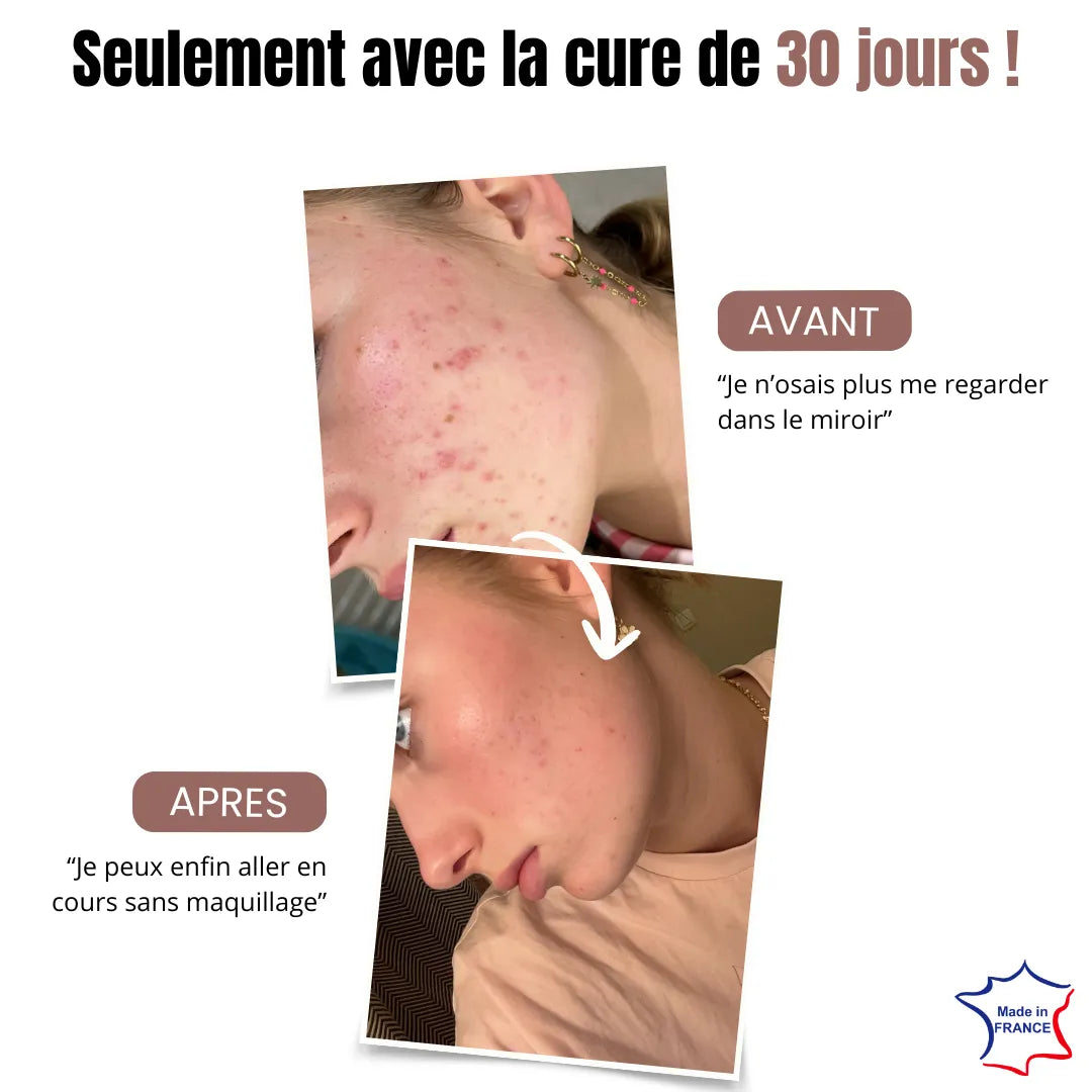 Cure Clean – Des résultats visibles en 7 jours